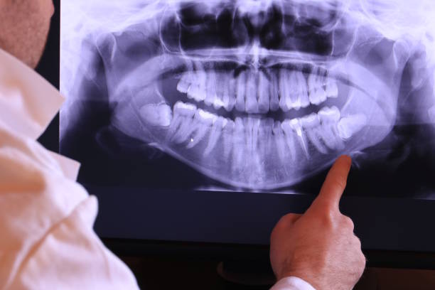 Best Emergency Treatment for Toothache in Toledo, OR