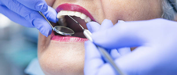 Best Emergency Broken Tooth Repair in Toledo, OR